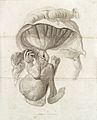 Foetus in a young man Wellcome L0034263.jpg