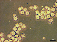 Des schizontes d'Ichthyophonus hoferi