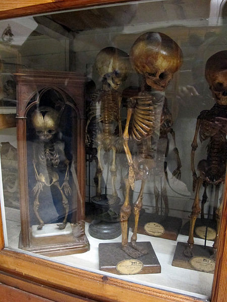 File:Istituto di anatomia umana normale, museo, campioni ossei 06 feti.JPG