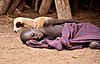 Malaria Patient, Nyangaton, Ethiopia (15151075077).jpg