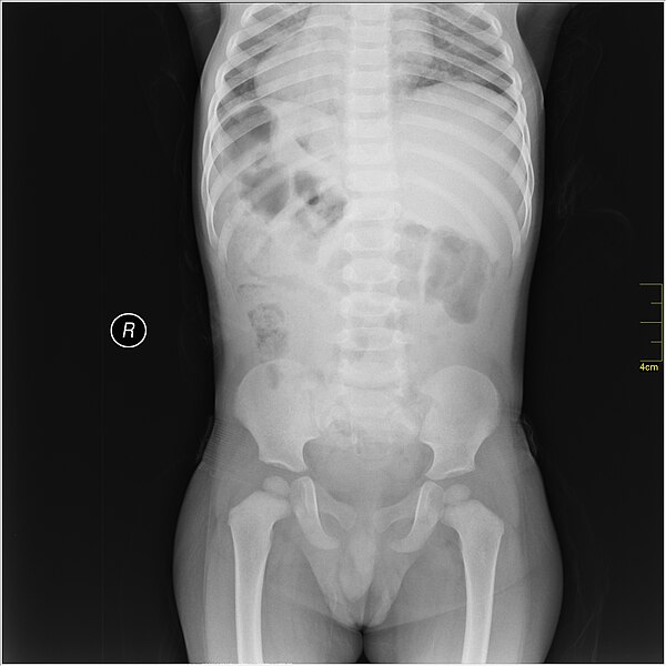 File:Medical X-Ray imaging VNV07 nevit.jpg