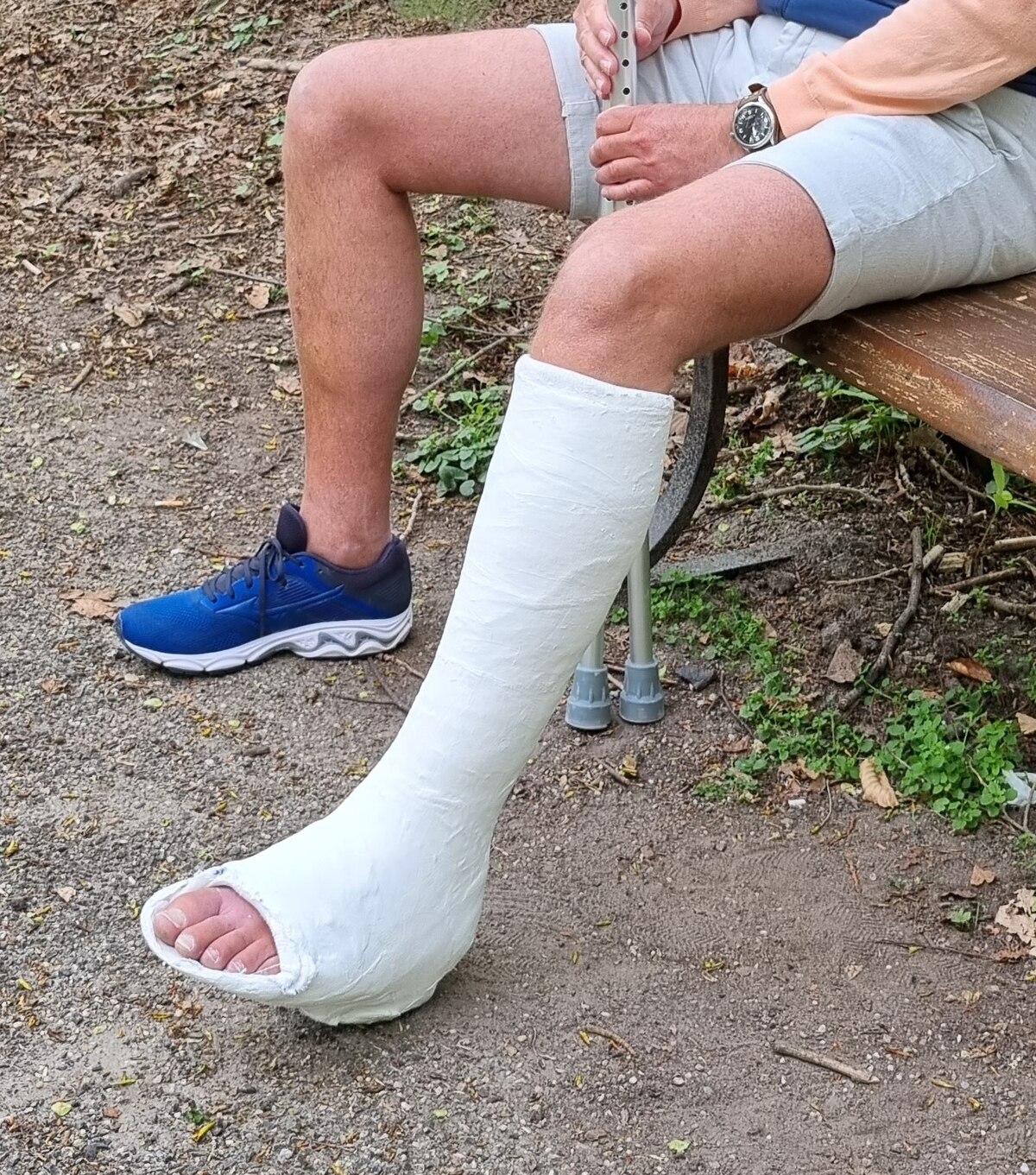 File:Plaster of Paris short leg walking cast with toeplate.jpg