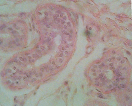 Stratified cuboidal epithelium, highlighting the nucleuses, the rest of the epithelial cells, and underlying connective tissue.