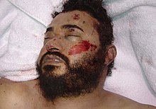 Corpse of Abu Musab al-Zarqawi, the leader of AQI, who was killed in a U.S. airstrike in Hibhib, 7 June 2006. Zarqawi dead us govt photo.jpg