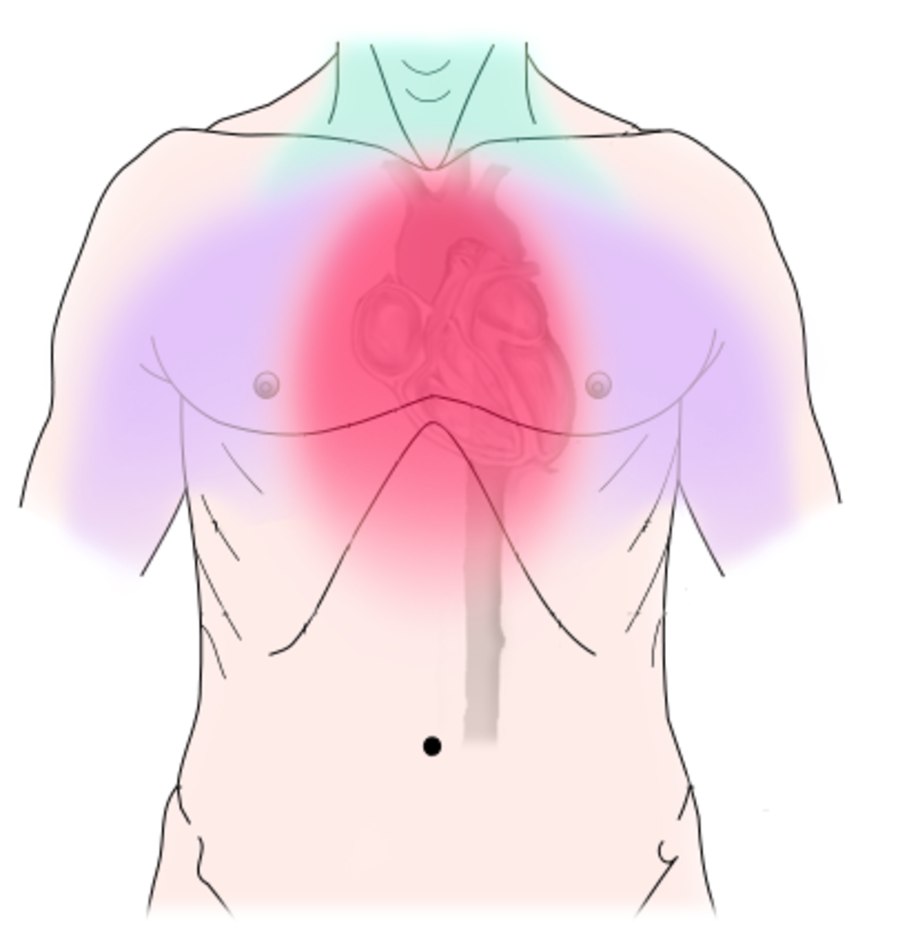 От чего может болеть грудная клетка. Дискомфорт за грудиной. Боль в грудной клетке.