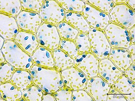 Calypogeia azurea laminacellen met chloroplasten en blauwe olielichaampjes