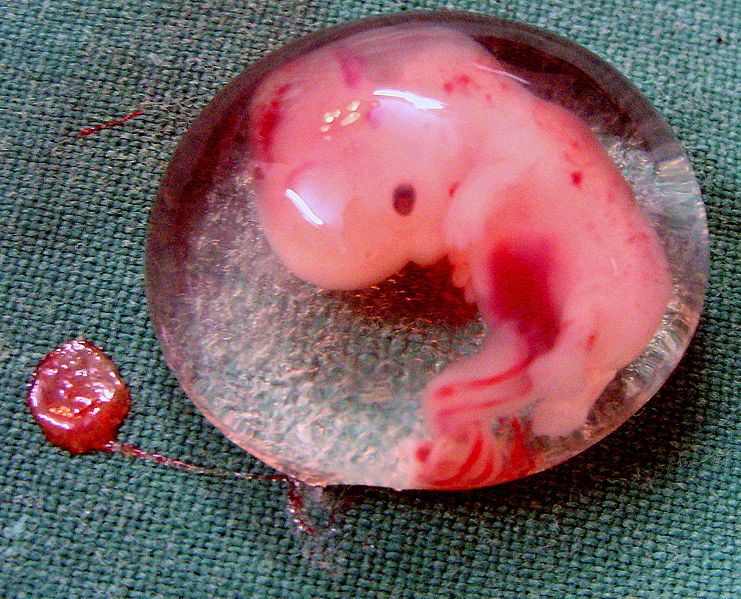 File:Human Embryo - (cropped).JPG