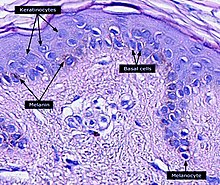 Micrograph of keratinocytes, basal cells and melanocytes in the epidermis Micrograph of keratinocytes, basal cells and melanocytes in the epidermis.jpg