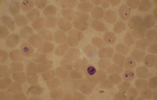 Blood smear from a P. falciparum culture (K1 strain - asexual forms) - several red blood cells have ring stages inside them. Close to the center is a schizont and on the left a trophozoite.