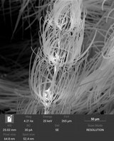 high resolution SEM image of Psychodidae (drain- or moth flies) whiskers segments
