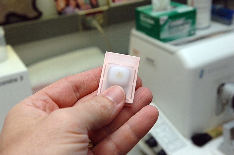 File:Tissue processing - After metal mould is removed, tissue can be seen in the paraffin block.jpg