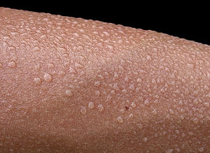 Close-up of beads of sweat