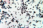 Thumbnail for Staphylococcus hyicus