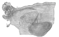 Broad ligament of adult, showing epoophoron.