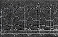 Sphygmographie intracardiaque: courbes de pression pulsée obtenue avec une cartographie des phases chronologiques de la contraction cardiaque, 1873.