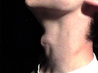 The laryngeal prominence, commonly known as the Adam's apple. Myneck.JPG