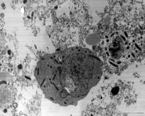 Rickettsia conorii в цитоплазмі клітини хазяїна