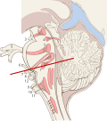Миниатюра для Файл:Brain stem sagittal section.svg