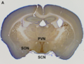 Miniatura para Núcleo paraventricular