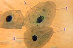 Vorschaubild für Chlamydophila pneumoniae