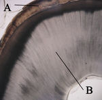 Histologic slide of tooth. Note the tubular appearance of dentin.
A: enamel
B: dentin Crosssectiontooth11-24-05.jpg