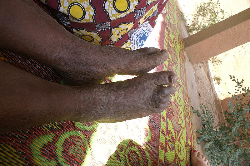 File:Feet from Burkina Faso2.JPG