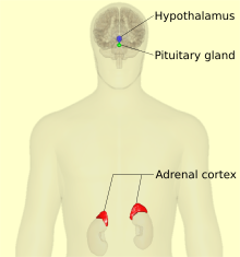 overactive adrenal cortex
