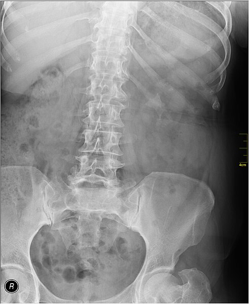 File:Medical X-Ray imaging SEO07 nevit.jpg