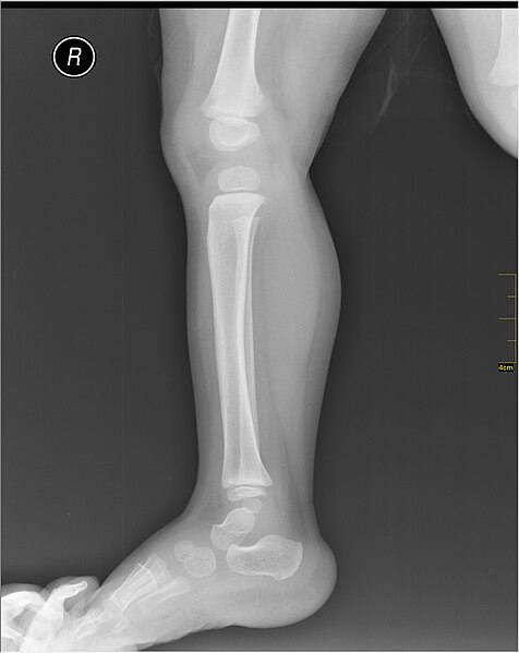 File:Medical X-Ray imaging TNU07 nevit.jpg