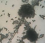 Rhizopus fungus.jpg