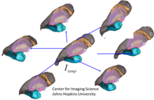 figure illustrant plusieurs systèmes de coordonnées générés à partir d'images IRM et générant un système de coordonnées modèle commun.