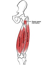 Thumbnail for Tensor vastus intermedius muscle