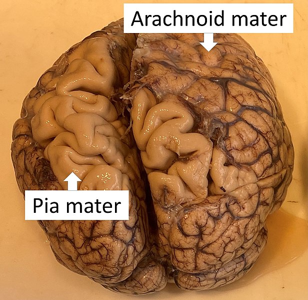 File:Brain with arachnoid and pia mater.jpg