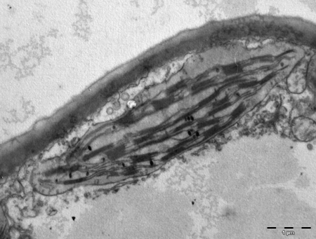 Tập tin:Chloroplast in leaf of Anemone sp TEM 12000x.png