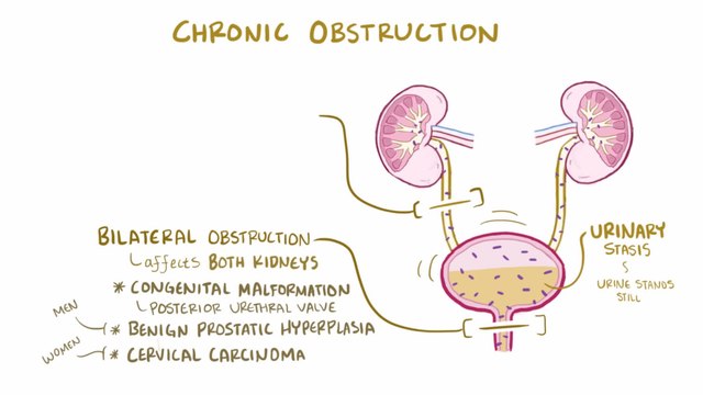 pyelonephritis symptoms