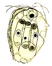 Collodictyon, das sich drei Scenedesmus-Zellen einverleibt hat[5]