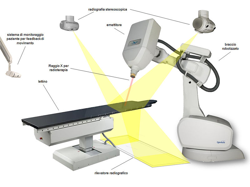 File:Cyberknife.jpg