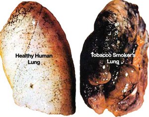 Fumo: Fumi derivati da combustione, Note, Voci correlate