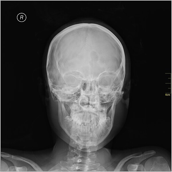 File:Medical X-Ray imaging SVQ07 nevit.jpg