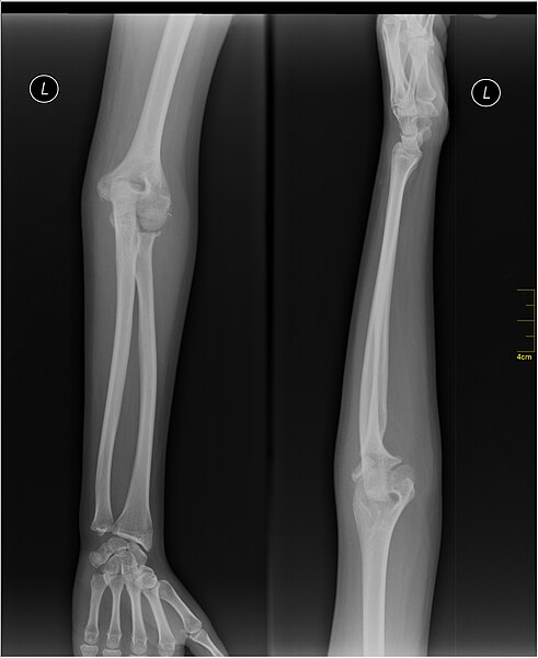 File:Medical X-Ray imaging WNU07 nevit.jpg