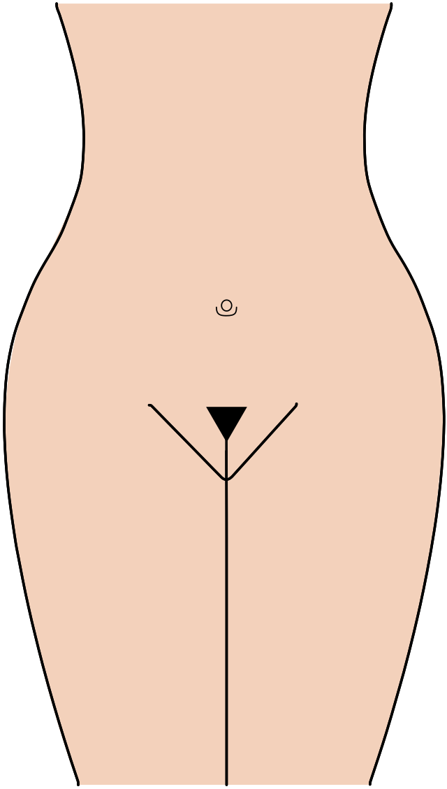 File:Pubic hairstyle triangle.svg - Wikimedia Commons.