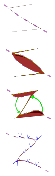 Diagram of a Z-plasty procedure. Z Plasty.svg