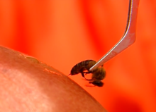 Bee sting being applied during an apitherapy session. Apiterapia1.png