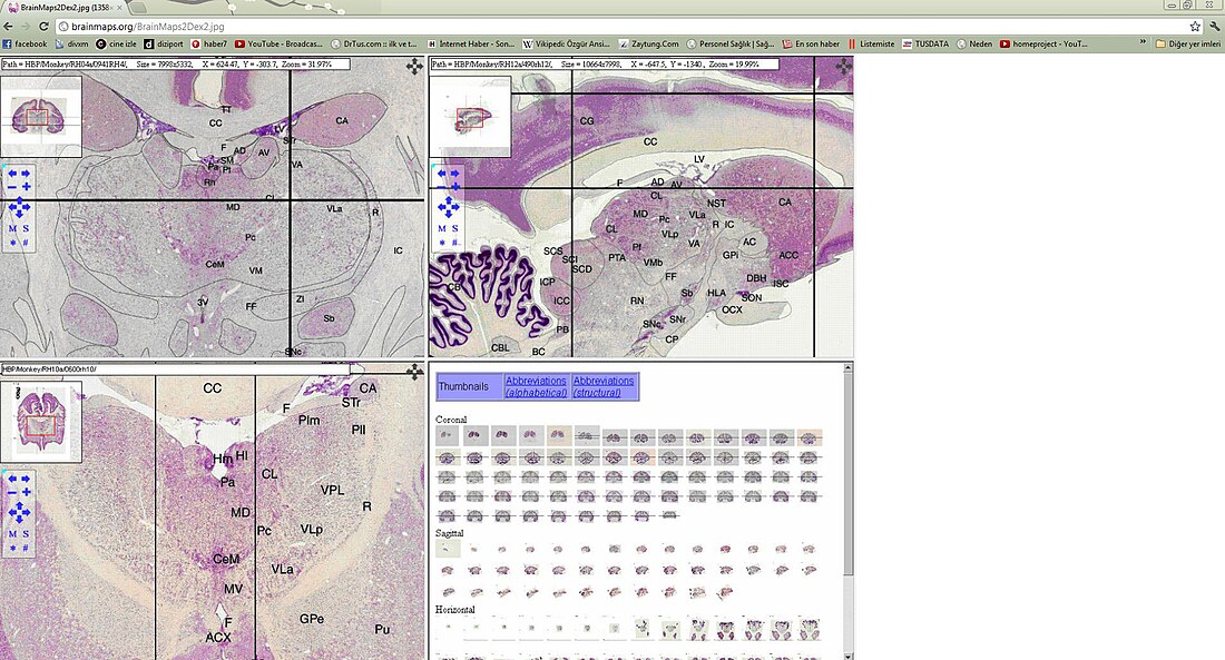 BrainMaps