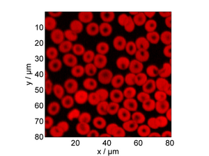 Photoacoustic micrograph of methanol fixed human red blood cells using 405 nm. HumanRBCsPAM.png