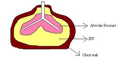 IPP lungs.jpg