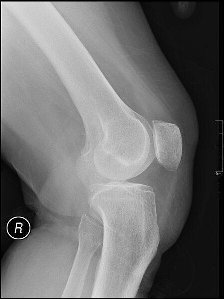 File:Medical X-Ray imaging COM03 nevit.jpg