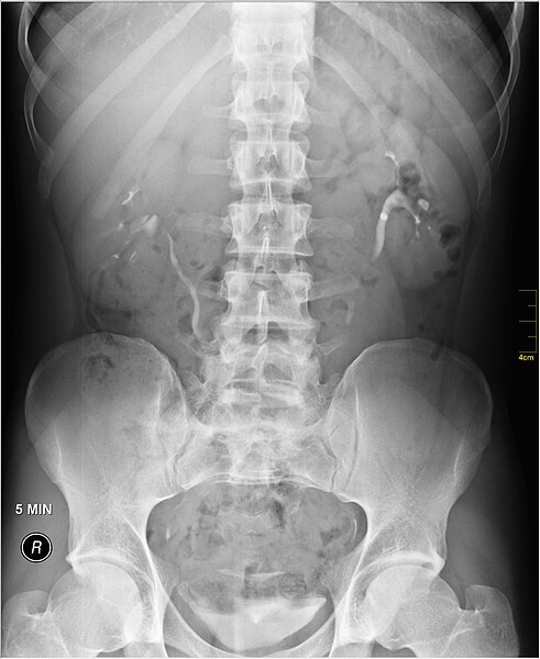 File:Medical X-Ray imaging SIS07 nevit.jpg