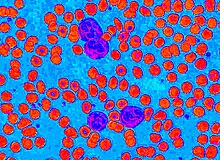 Hue component Neutrophils-hue.jpg