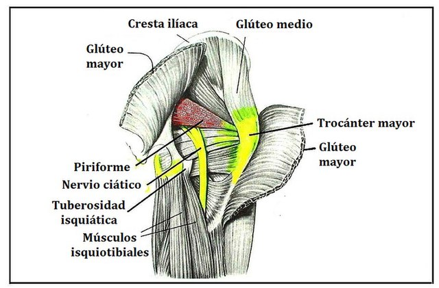 Piriformis syndrome - Wikipedia